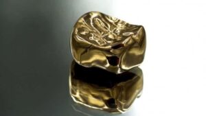 Where To Sell Dental Gold?